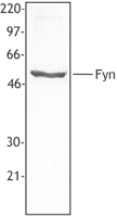 SYN / FYN Antibody - Extracts from human PBMC were resolved by electrophoresis, transferred to nitrocellulose, and probed with monoclonal antibody against Fyn. Proteins were visualized using a goat anti-mouse secondary conjugated to HRP and a chemiluminescence detection system.