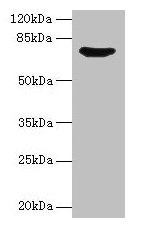 SYN1 / Synapsin 1 Antibody - Western blot All lanes: Synapsin-1 antibody at 12µg/ml + Mouse brain tissue Secondary Goat polyclonal to rabbit IgG at 1/10000 dilution Predicted band size: 75, 71 kDa Observed band size: 75 kDa