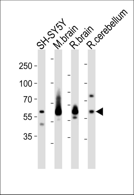 SYN1 / Synapsin 1 Antibody - Western blot of lysates from SH-SY5Y cell line, mouse brain, rat brain, rat cerebellum tissue (from left to right), using SYN1 Antibody. Antibody was diluted at 1:1000 at each lane. A goat anti-rabbit IgG H&L (HRP) at 1:10000 dilution was used as the secondary antibody. Lysates at 20ug per lane.
