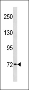 SYN1 / Synapsin 1 Antibody - SYN1 Antibody western blot of HL-60 cell line lysates (35 ug/lane). The SYN1 antibody detected the SYN1 protein (arrow).