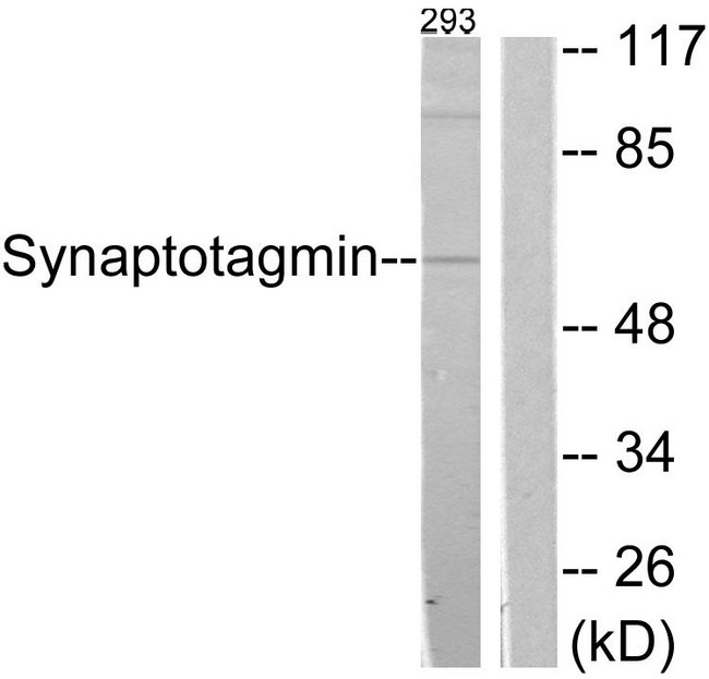 Synaptotagmin Antibody - Western blot analysis of lysates from 293 cells, treated with Forskolin 40nM 30', using Synaptotagmin Antibody. The lane on the right is blocked with the synthesized peptide.