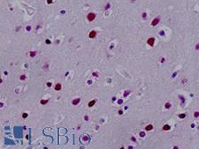 SYNCRIP / HnRNP Q Antibody - Human, Brain, neurons: Formalin-Fixed Paraffin-Embedded (FFPE)