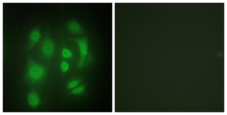 SYNCRIP / HnRNP Q Antibody - Immunofluorescence analysis of HepG2 cells, using hnRNP Q Antibody. The picture on the right is blocked with the synthesized peptide.