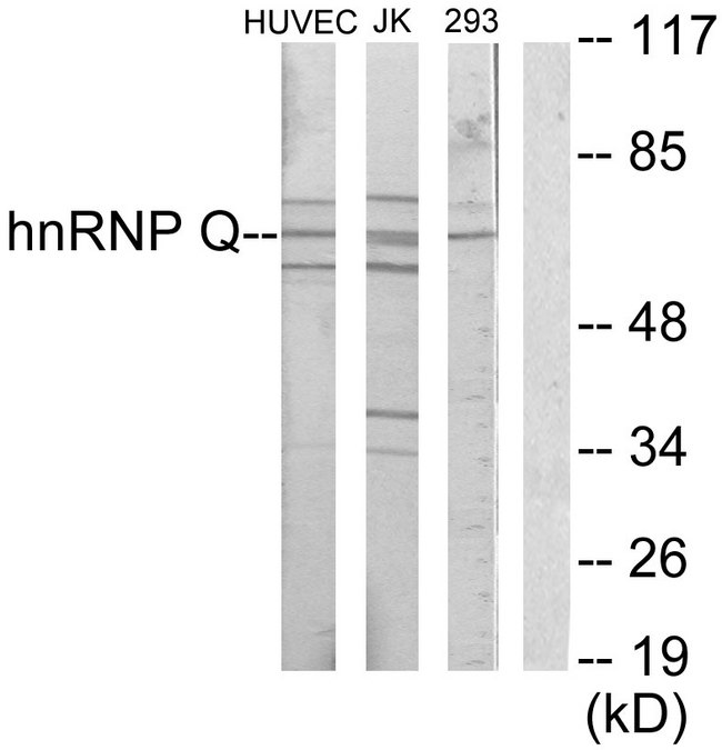 SYNCRIP / HnRNP Q Antibody - Western blot analysis of lysates from Jurkat, HUVEC, and 293 cells, using hnRNP Q Antibody. The lane on the right is blocked with the synthesized peptide.