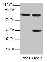 SYNCRIP / HnRNP Q Antibody - Western blot All lanes: Heterogeneous nuclear ribonucleoprotein Q antibody at 2µg/ml Lane 1: EC109 whole cell lysate Lane 2: 293T whole cell lysate Secondary Goat polyclonal to rabbit IgG at 1/15000 dilution Predicted band size: 70, 66, 63, 59, 47 kDa Observed band size: 70, 36 kDa