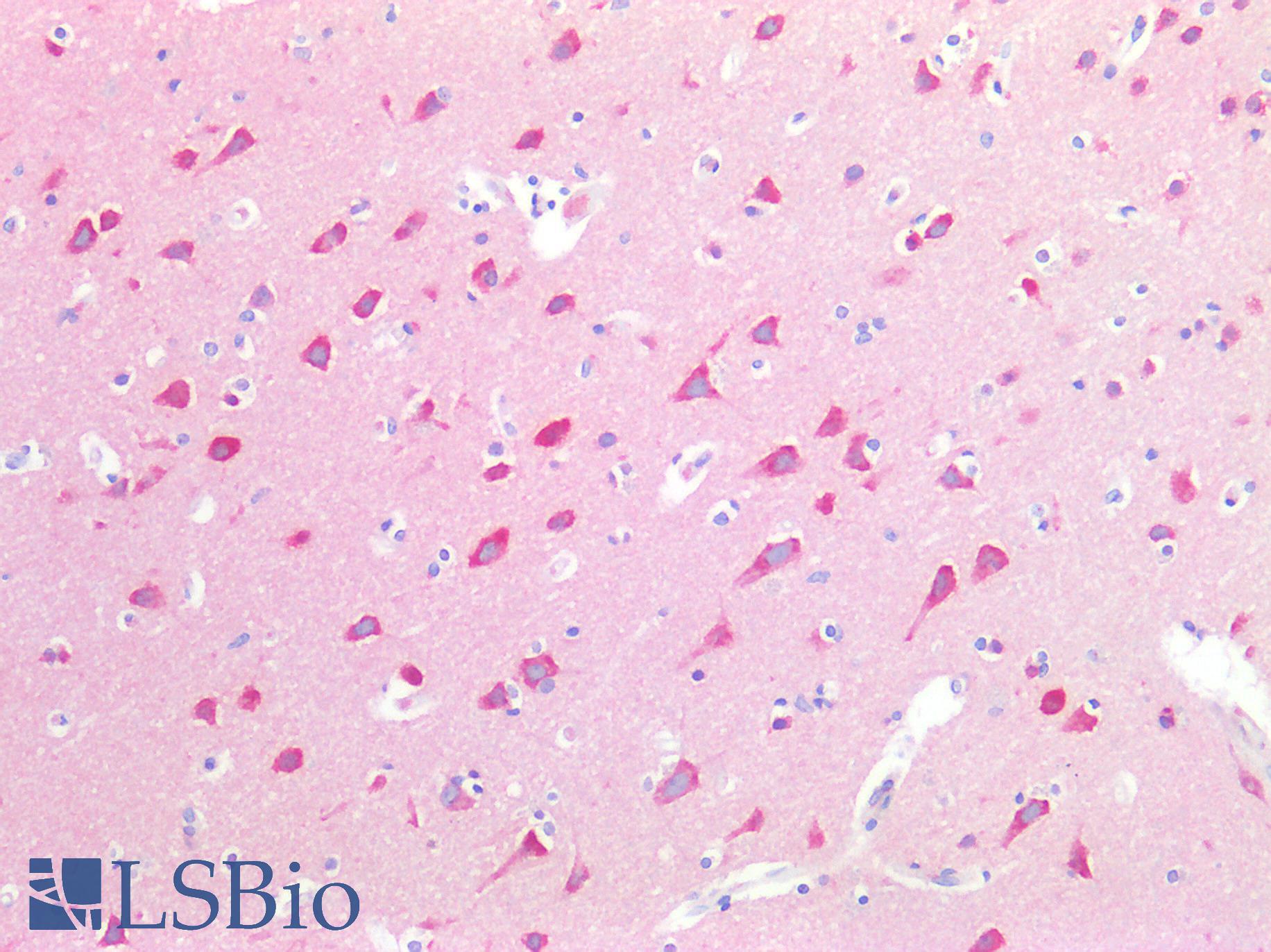 Syndapin I / PACSIN1 Antibody - Human Brain, Cortex: Formalin-Fixed, Paraffin-Embedded (FFPE)