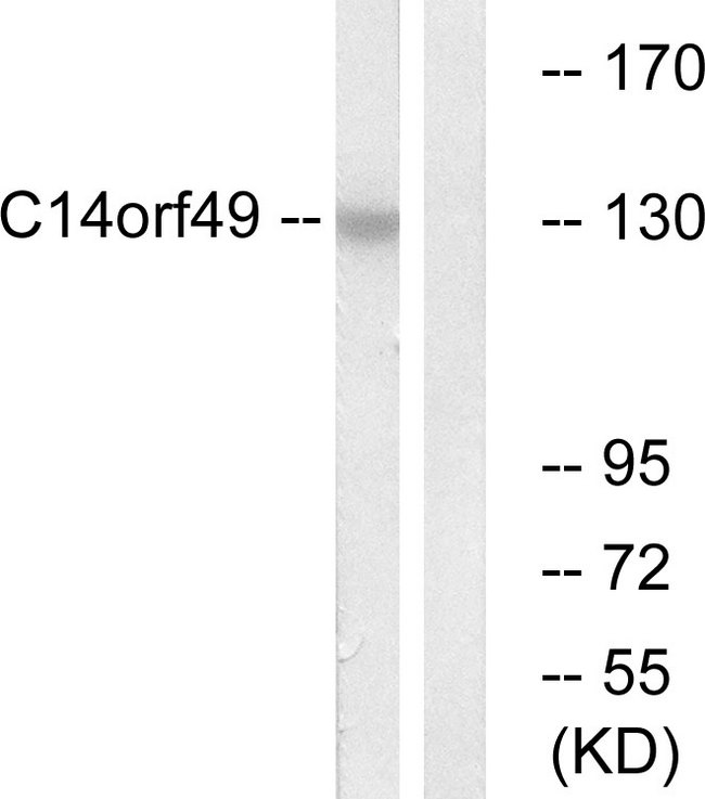 SYNE3 / C14orf49 Antibody - Western blot analysis of lysates from Jurkat cells, using C14orf49 Antibody. The lane on the right is blocked with the synthesized peptide.