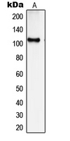 SYNE3 / C14orf49 Antibody - Western blot analysis of SYNE3 expression in HepG2 (A) whole cell lysates.