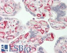 SYNE3 / C14orf49 Antibody - Human Placenta: Formalin-Fixed, Paraffin-Embedded (FFPE)