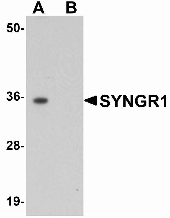 SYNGR1 / Synaptogyrin 1 Antibody - Western blot of SYNGR1 in rat brain tissue lysate with SYNGR1 antibody at 1 ug/ml in (A) the absence and (B) the presence of blocking peptide.