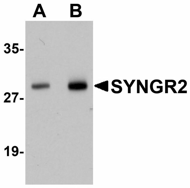 SYNGR2 / Synaptogyrin 2 Antibody - Western blot of SYNGR2 in human lung tissue lysate with SYNGR2 antibody at (A) 1 and (B) 2 ug/ml.