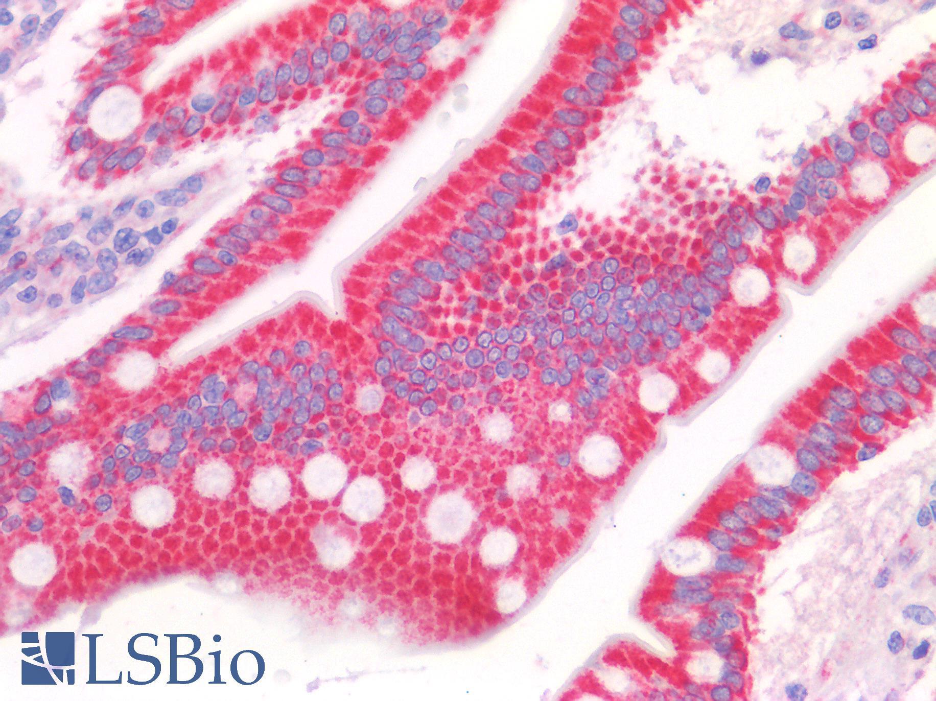 SYNJ2BP / OMP25 Antibody - Human Small Intestine: Formalin-Fixed, Paraffin-Embedded (FFPE)