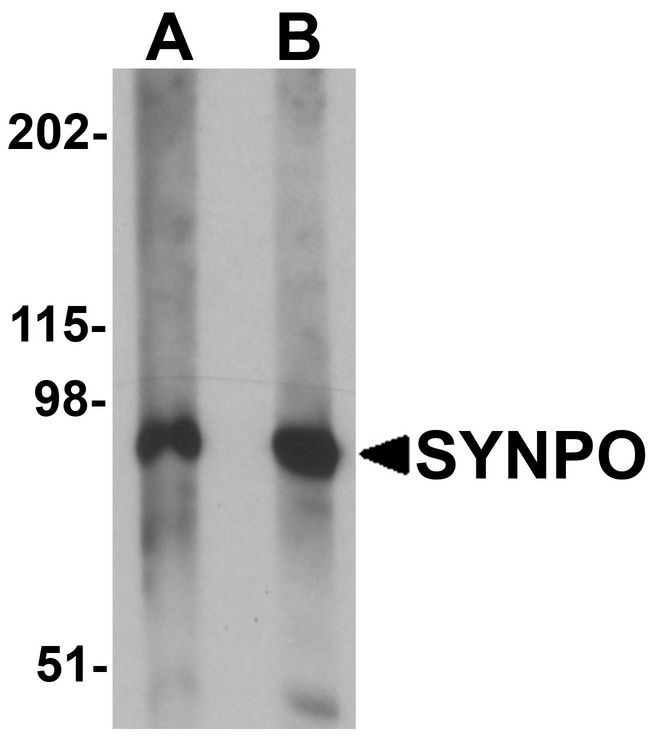 SYNPO / Synaptopodin Antibody - Western blot analysis of SYNPO in rat brain tissue lysate with SYNPO antibody at (A) 1 and (B) 2 ug/ml.