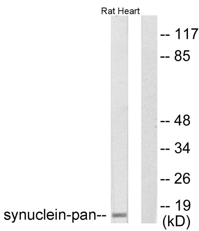 Synuclein Antibody - Western blot analysis of lysates from rat heart cells, using Synuclein-pan Antibody. The lane on the right is blocked with the synthesized peptide.