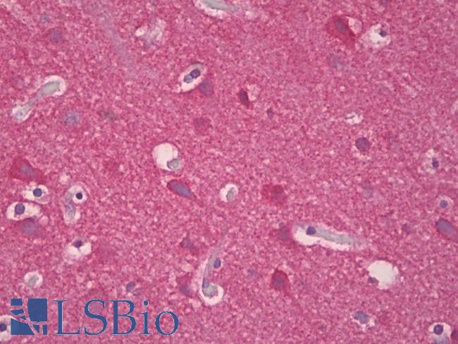 Synuclein Antibody - Anti-Synuclein antibody IHC of human brain, cortex. Immunohistochemistry of formalin-fixed, paraffin-embedded tissue after heat-induced antigen retrieval. Antibody dilution 1:100.
