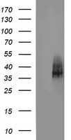 SYP / Synaptophysin Antibody - HEK293T cells were transfected with the pCMV6-ENTRY control (Left lane) or pCMV6-ENTRY SYP (Right lane) cDNA for 48 hrs and lysed. Equivalent amounts of cell lysates (5 ug per lane) were separated by SDS-PAGE and immunoblotted with anti-SYP.