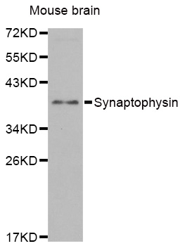 SYP / Synaptophysin Antibody - Western blot analysis of extracts of Mouse brain cells.