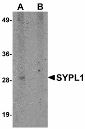 SYPL1 Antibody - Western blot of SYPL1 in human brain tissue lysate with SYPL1 antibody at 1 ug/ml in (A) the absence and (B) the presence of blocking peptide.