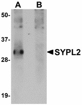 SYPL2 Antibody - Western blot of SYPL2 in human spleen tissue lysate with SYPL2 antibody at 1 ug/ml in (A) the absence and (B) the presence of blocking peptide.