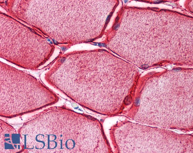 SYPL2 Antibody - Anti-SYPL2 antibody IHC of human skeletal muscle. Immunohistochemistry of formalin-fixed, paraffin-embedded tissue after heat-induced antigen retrieval. Antibody concentration 5 ug/ml.