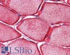 SYPL2 Antibody - Anti-SYPL2 antibody IHC of human skeletal muscle. Immunohistochemistry of formalin-fixed, paraffin-embedded tissue after heat-induced antigen retrieval. Antibody concentration 5 ug/ml.