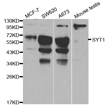 SYT1 / Synaptotagmin Antibody - Western blot analysis of extracts of various cell lines, using SYT1 antibody.