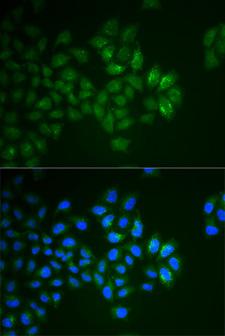 SYT1 / Synaptotagmin Antibody - Immunofluorescence analysis of HeLa cell using SYT1 antibody. Blue: DAPI for nuclear staining.