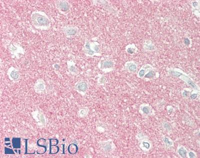 SYT1 / Synaptotagmin Antibody - Human Brain, Cortex: Formalin-Fixed, Paraffin-Embedded (FFPE)