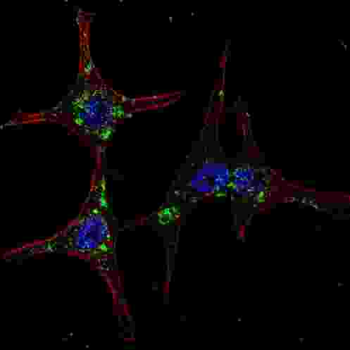 SYVN1 / HRD1 Antibody - Fluorescent confocal image of HeLa cells stained with SYVN1 (HRD1) antibody. HeLa cells were fixed with 4% PFA (20 min), permeabilized with Triton X-100 (0.2%, 30 min). Cells were then incubated SYVN1 (HRD1) primary antibody (1:200, 2 h at room temperature). For secondary antibody, Alexa Fluor 488 conjugated donkey anti-rabbit antibody (green) was used (1:1000, 1h). Nuclei were counterstained with Hoechst 33342 (blue) (10 ug/ml, 5 min).