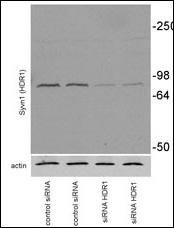SYVN1 / HRD1 Antibody - Mouse Neuroblastoma Neuro2A (N2A) was transiently transfected, collected at 72h after transfection. Primary antibodies against syvn1 (1:1000) and anti-rabbit secondary POD-conjugated antibodies from Pierce Biotechnology, Inc (Rockford, IL, 1:2000)(Provided by Dr. Susana Granell & Institution University of Arkansas).