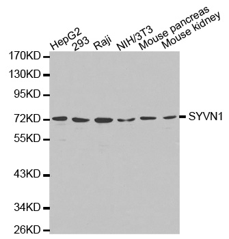 SYVN1 / HRD1 Antibody - Western blot analysis of extracts of various cell lines, using SYVN1 antibody.