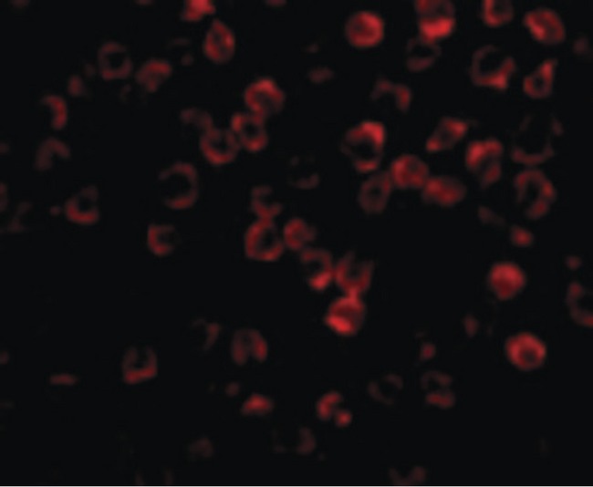 TAB1 Antibody - Immunofluorescence of TAB1 in 3T3 cells with TAB1 antibody at 2 ug/ml.
