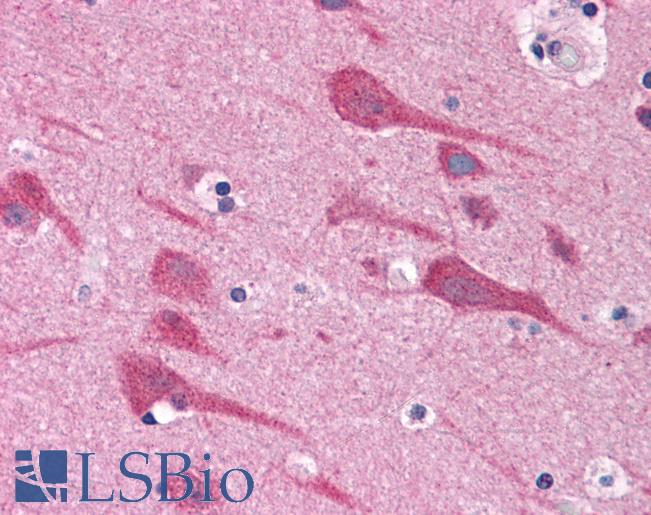 TAB2 Antibody - Anti-TAB2 antibody IHC of human brain, cortex. Immunohistochemistry of formalin-fixed, paraffin-embedded tissue after heat-induced antigen retrieval. Antibody concentration 5 ug/ml.