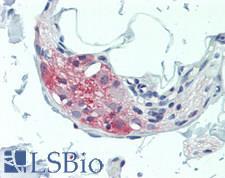 TAC1  Antibody - Human Colon, Submucosal Plexus: Formalin-Fixed, Paraffin-Embedded (FFPE), at a dilution of 1:100.