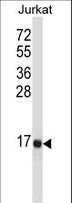 TAC3 / Tachykinin Antibody - TAC3 Antibody western blot of Jurkat cell line lysates (35 ug/lane). The TAC3 antibody detected the TAC3 protein (arrow).