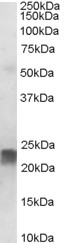 TAGLN / Transgelin / SM22 Antibody - Antibody staining (0.001 ug/ml) of Human Placenta lysate (RIPA buffer, 35 ug total protein per lane). Primary incubated for 1 hour. Detected by Western blot of chemiluminescence.