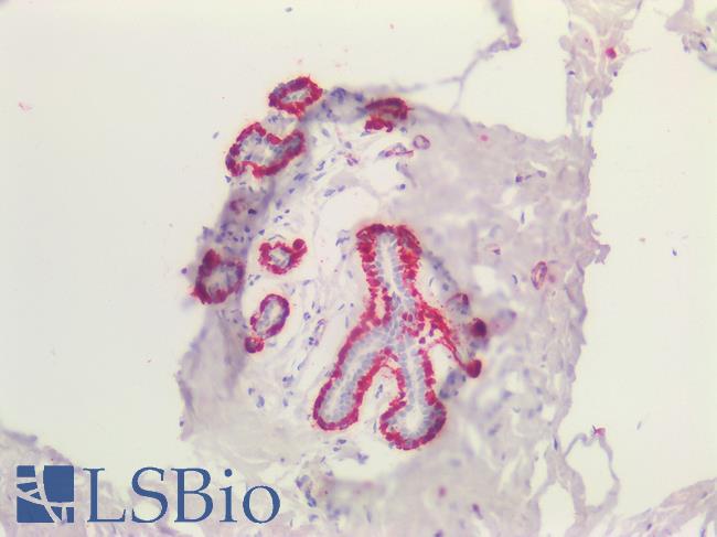 TAGLN / Transgelin / SM22 Antibody - Human Breast: Formalin-Fixed, Paraffin-Embedded (FFPE)