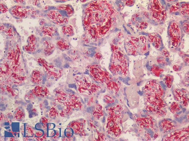 TAGLN / Transgelin / SM22 Antibody - Human Placenta: Formalin-Fixed, Paraffin-Embedded (FFPE) HIER using 10 mM sodium citrate buffer pH 6.