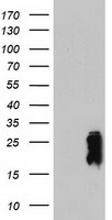 TAGLN / Transgelin / SM22 Antibody - HEK293T cells were transfected with the pCMV6-ENTRY control (Left lane) or pCMV6-ENTRY TAGLN (Right lane) cDNA for 48 hrs and lysed. Equivalent amounts of cell lysates (5 ug per lane) were separated by SDS-PAGE and immunoblotted with anti-TAGLN.