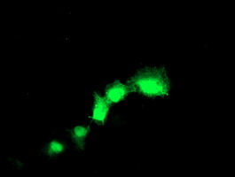 TAGLN / Transgelin / SM22 Antibody - Anti-TAGLN mouse monoclonal antibody immunofluorescent staining of COS7 cells transiently transfected by pCMV6-ENTRY TAGLN.