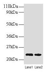 TAGLN / Transgelin / SM22 Antibody - Western blot All lanes: Transgelin antibody at 2µg/ml Lane 1: EC109 whole cell lysate Lane 2: 293T whole cell lysate Secondary Goat polyclonal to rabbit IgG at 1/15000 dilution Predicted band size: 22 kDa Observed band size: 22 kDa