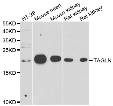 TAGLN / Transgelin / SM22 Antibody - Western blot analysis of extracts of various cell lines.