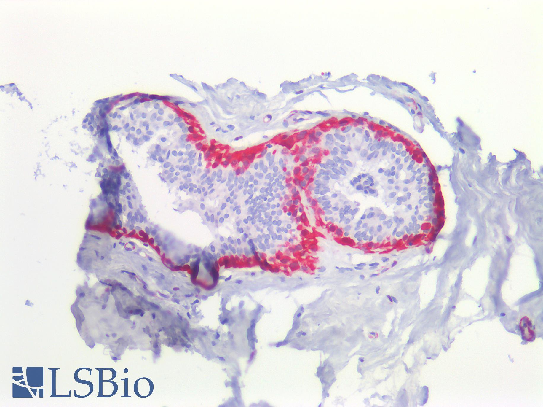 TAGLN / Transgelin / SM22 Antibody - Human Breast: Formalin-Fixed, Paraffin-Embedded (FFPE)