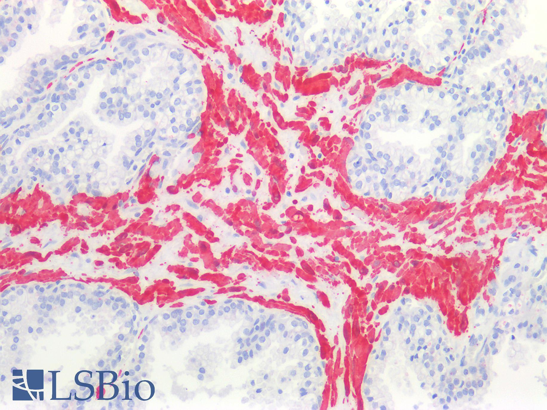TAGLN / Transgelin / SM22 Antibody - Human Prostate: Formalin-Fixed, Paraffin-Embedded (FFPE)