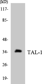 TAL1 Antibody - Western blot analysis of the lysates from HT-29 cells using TAL-1 antibody.