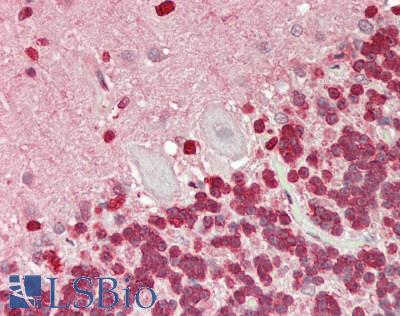 TALDO1 / Transaldolase 1 Antibody - Human Brain, Cerebellum: Formalin-Fixed, Paraffin-Embedded (FFPE)