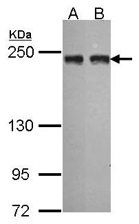 TANGO / MIA3 Antibody - Lane A: A549 (30 ug of whole cell lysate). Lane B: Hep G2 (30 ug of whole cell lysate). Anti-MIA3 Antibody diluted at 1:1000 