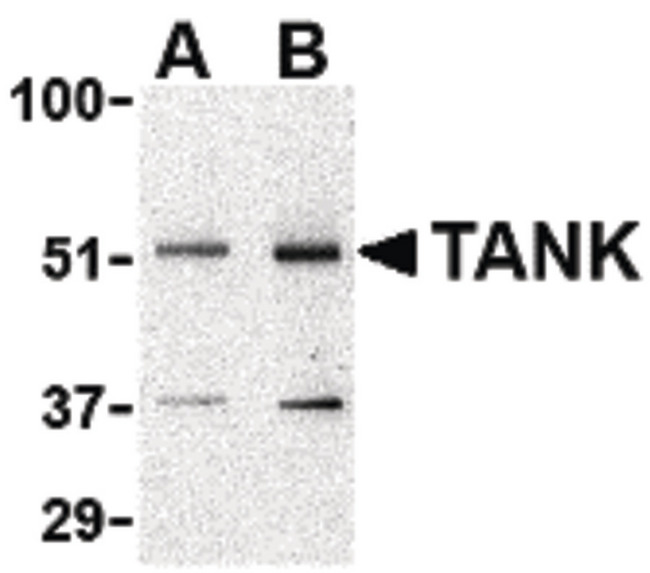 TANK Antibody - Western blot of TANK in Daudi cell lysate with TANK antibody at (A) 0.5 and (B) 1 ug/ml.