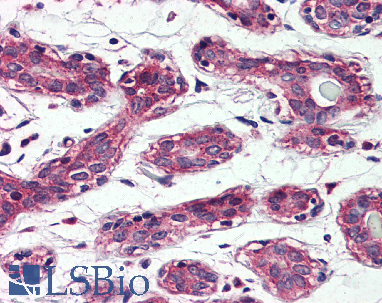TAOK1 / TAO1 Antibody - Anti-TAOK1 antibody IHC of human breast. Immunohistochemistry of formalin-fixed, paraffin-embedded tissue after heat-induced antigen retrieval.