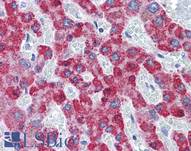 TAOK2 / TAO2 Antibody - Anti-TAOK2 antibody IHC of human liver. Immunohistochemistry of formalin-fixed, paraffin-embedded tissue after heat-induced antigen retrieval. Antibody concentration 5 ug/ml.